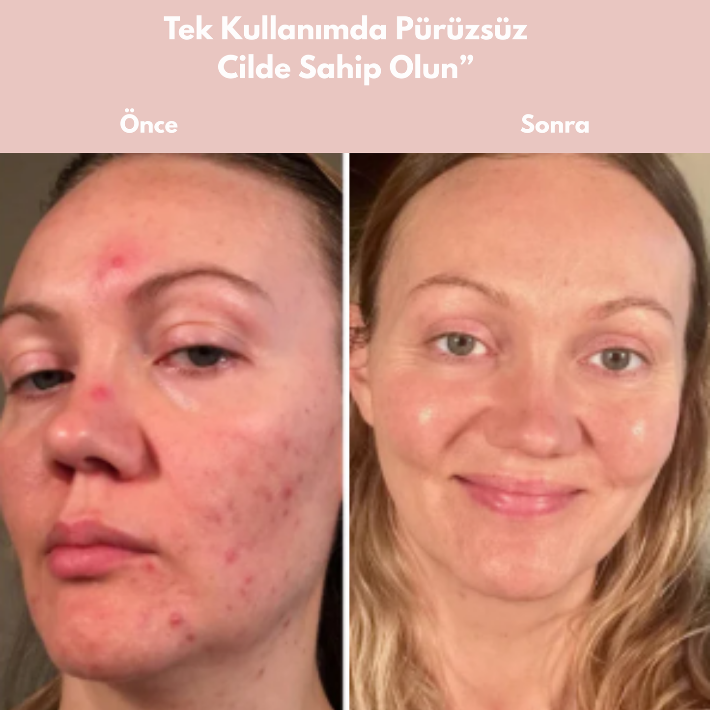 Elara Beauty Bio Kolajen Maskesi